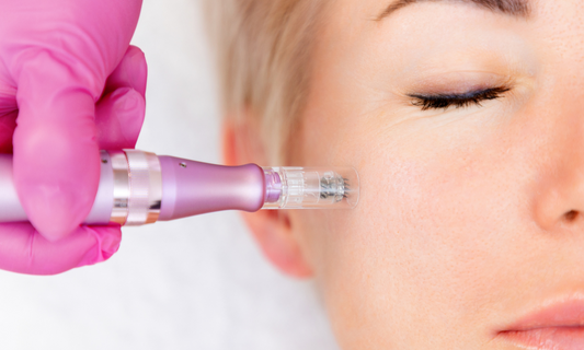 Dermal Microneedling (45 min)